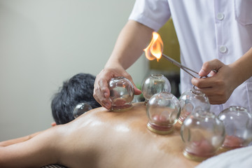 Acupuncture and Wellness – The Benefits of Cupping